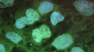 Canadian Clinics Are Selling Shady Stem Cell Treatments, Study Finds